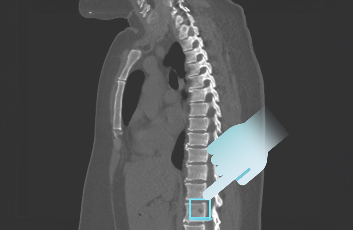 03 digitales roentgen rheinische radiologie koeln porz suelz